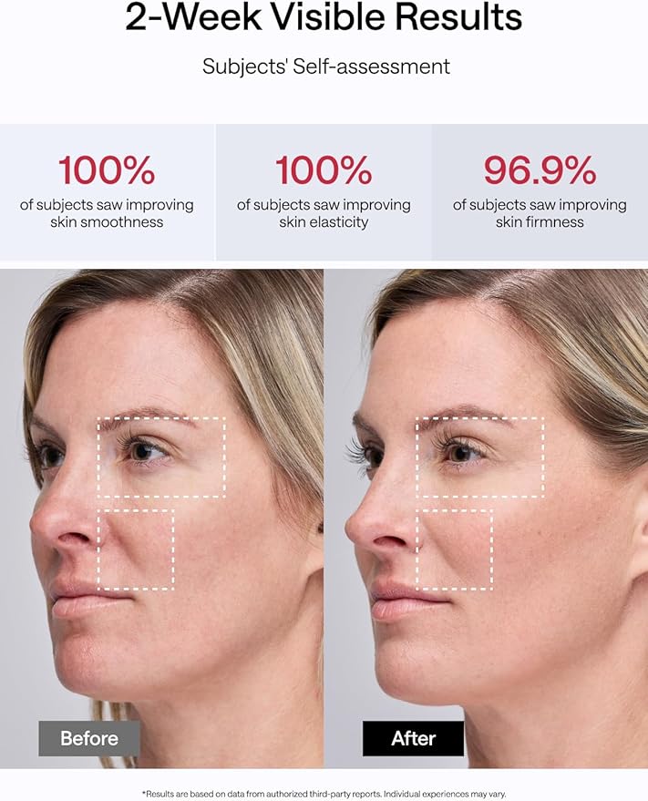 JMOON NouvelleSkin Facial Toning Device, FDA-Cleared Microcurrent Facial Device and Red Light Therapy for Face, 4 Modes & 5 Intensity Levels for Personalized Face Lift & Smoothing. M30U PR - The Vitality Estate