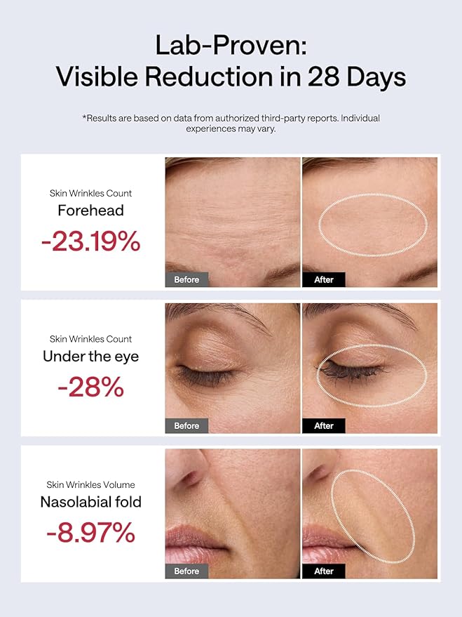 JMOON NouvelleSkin Facial Toning Device, FDA-Cleared Microcurrent Facial Device and Red Light Therapy for Face, 4 Modes & 5 Intensity Levels for Personalized Face Lift & Smoothing. M30U PR - The Vitality Estate